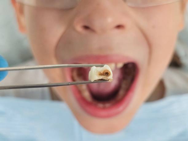 Best Emergency Pediatric Dentist  in Oasis, CA